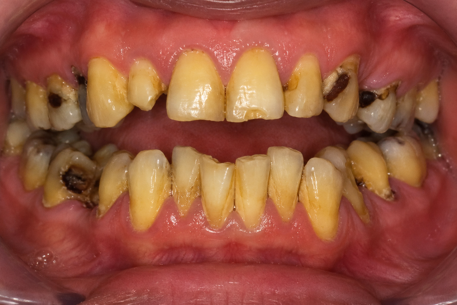 Before treatment